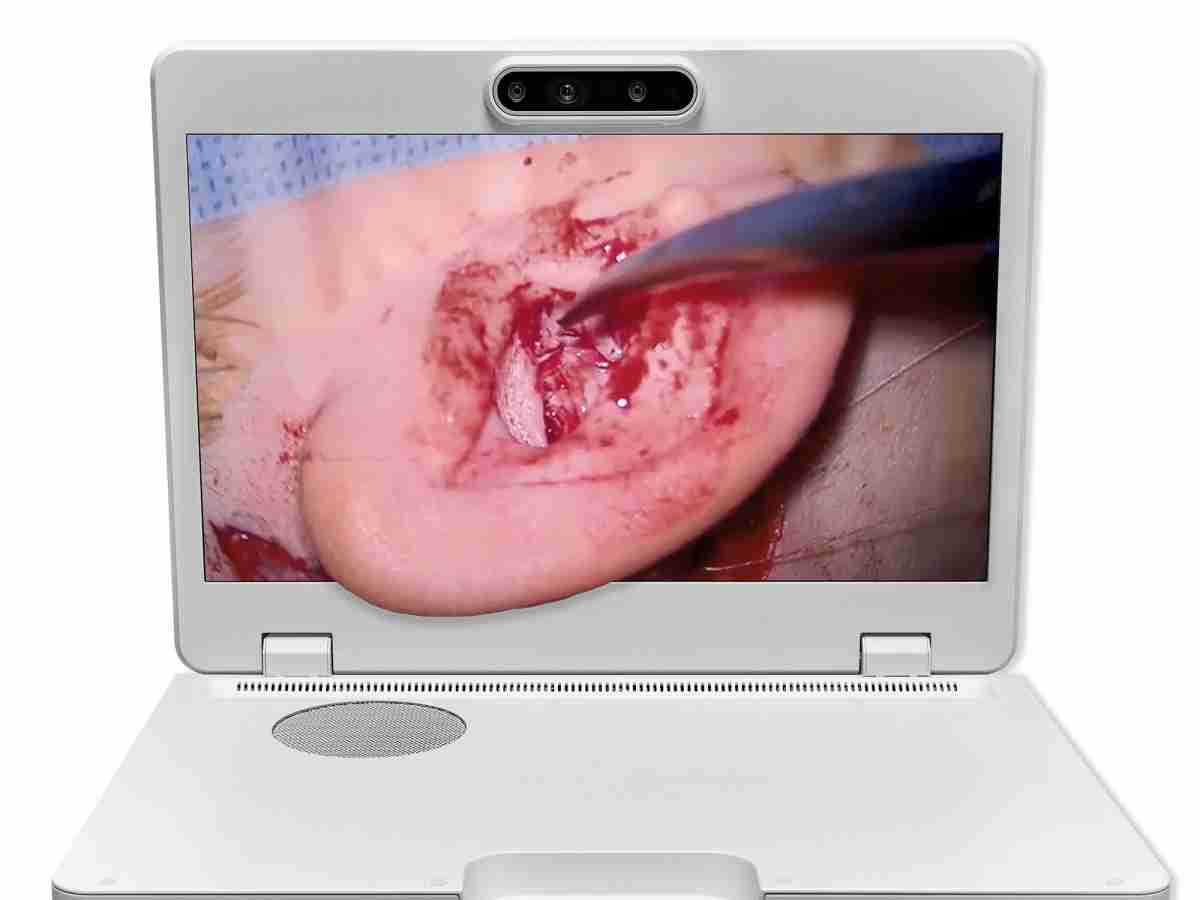 达擎之＂Heads-up 3D显微手术显示系统＂，，，整合4K裸眼3D显示及眼球追踪系统，，，，具备快速追踪人眼移动位置功能，，，，减轻医师长时间维持固定姿势的负担，，让医师能有更宽广清晰的3D立体视野及更舒适的姿势来执行手术。。。。